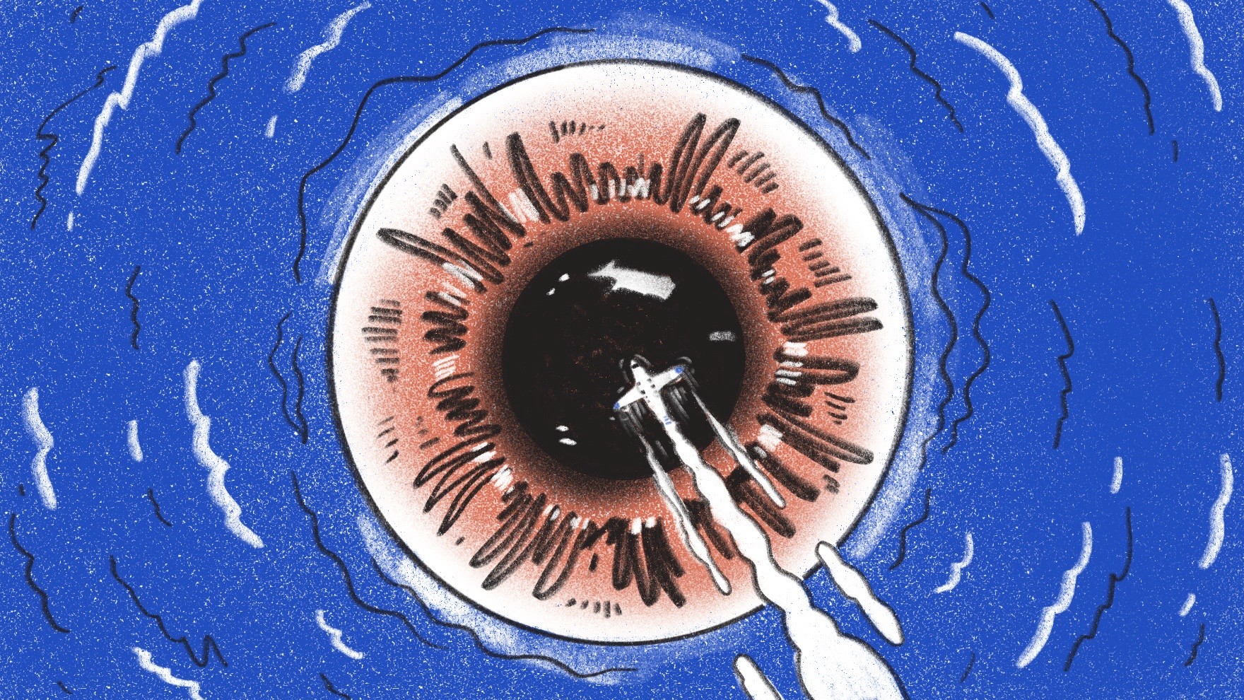 Eyeball